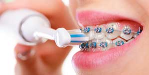 higiene-dental-amb-ortodoncia