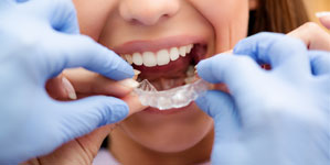 ortodoncia-invisible-vs-tradicional-dst