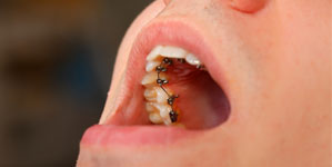 ortodoncia lingual